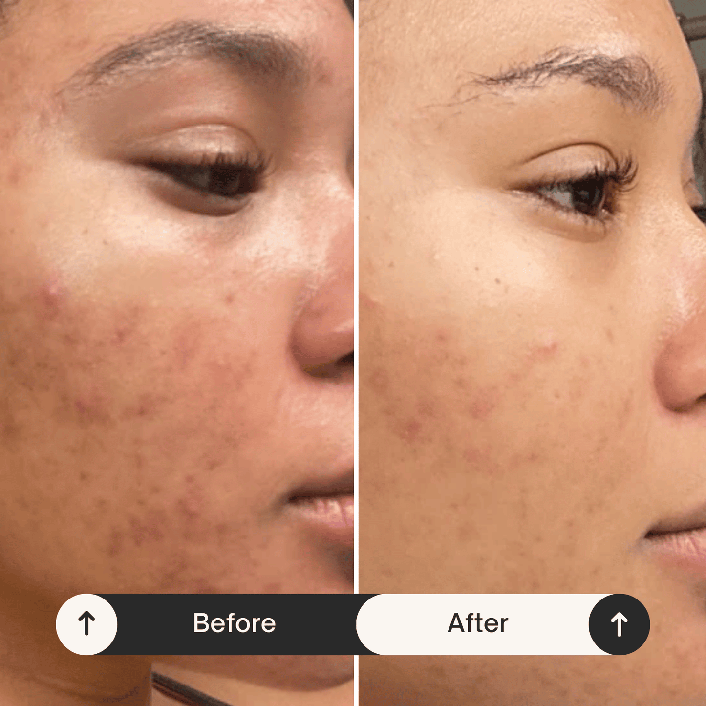 LOVILDS™ Dark Spot Remover for Face and Body