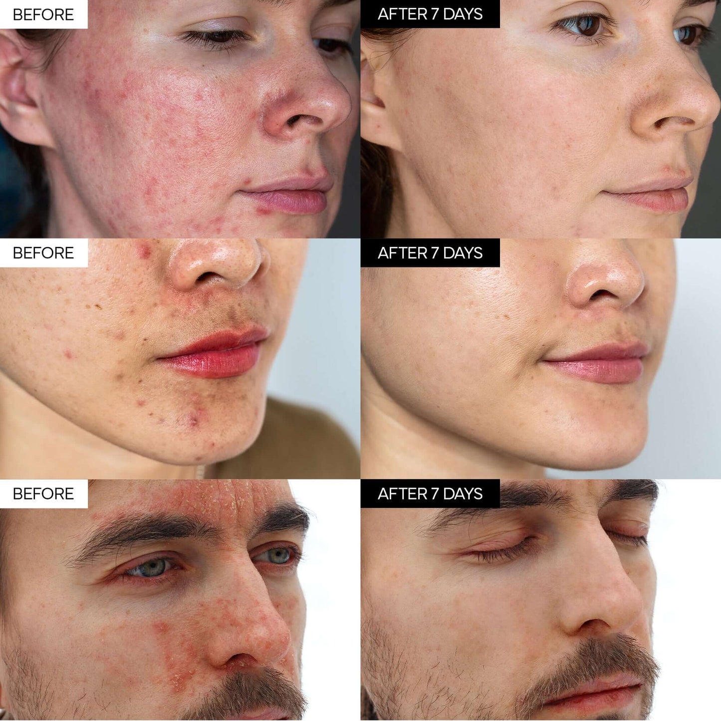 Final 3 Hours:70%OFF🔥Intensive Cica Repair Cream