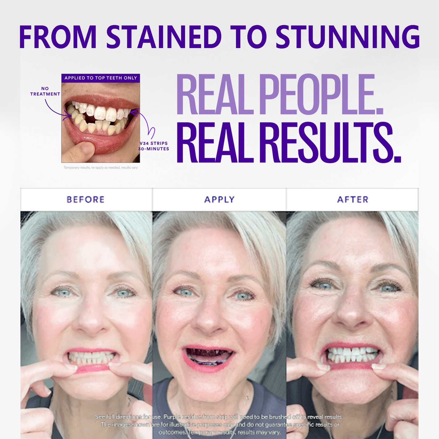 😁 SmileFitPro™ V36 Whitening Strips