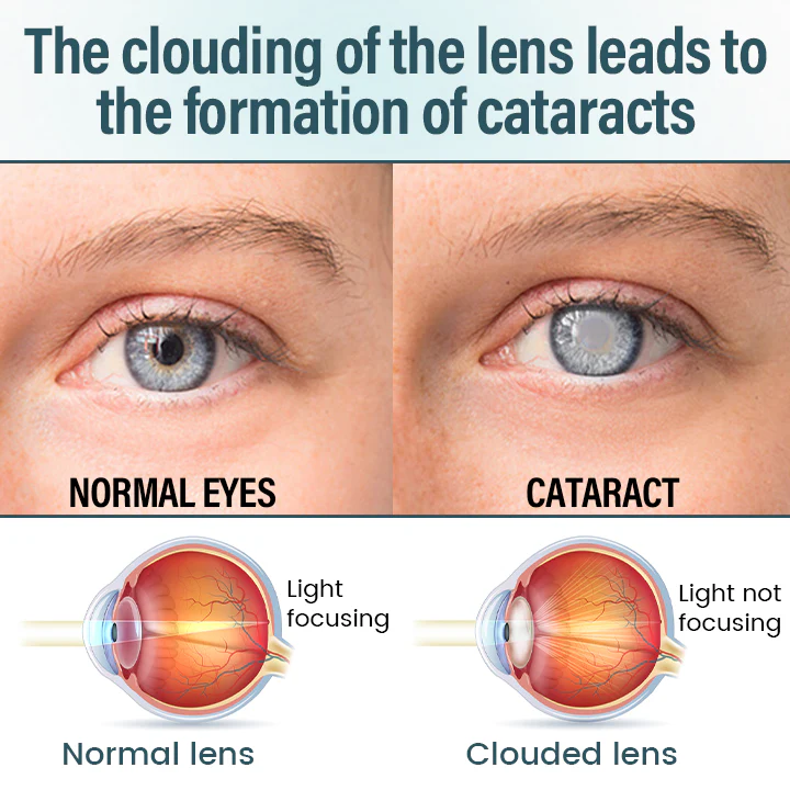 LOVILDS® OptiFusion Nano Eye Drops Serum