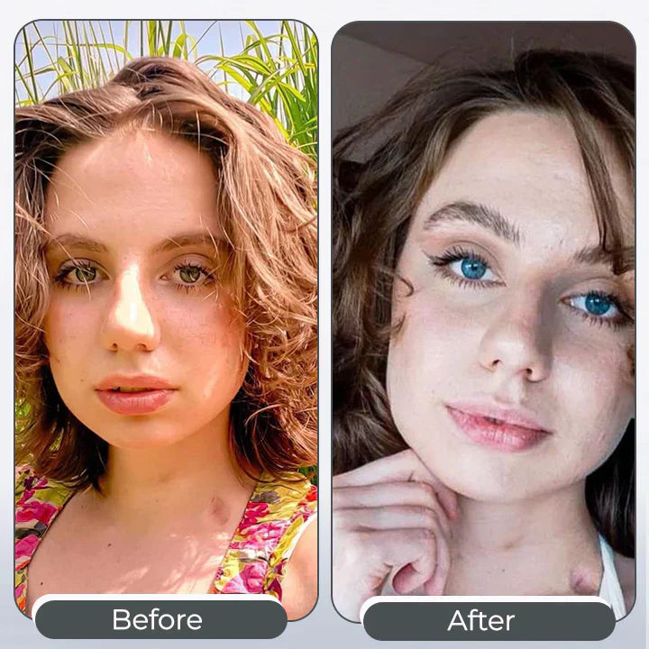 ✨𝑺𝒑𝒆𝒄𝒕𝒓𝒂𝑬𝒚𝒆 𝑪𝒐𝒍𝒐𝒓 𝑪𝒉𝒂𝒏𝒈𝒊𝒏𝒈 𝑫𝒓𝒐𝒑𝒔 𝑷𝒓𝒐🏆🏆