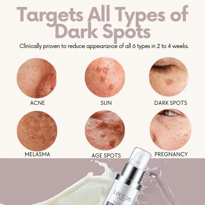 LOVILDS™ Dark Spot Remover for Face and Body