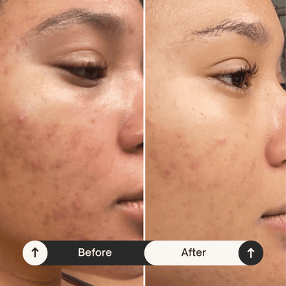 LOVILDS™ Dark Spot Remover for Face and Body