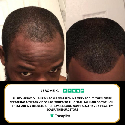 🌈🌈Final 3 Hours:60%OFF🔥 Natural Hair Density Essential Oil